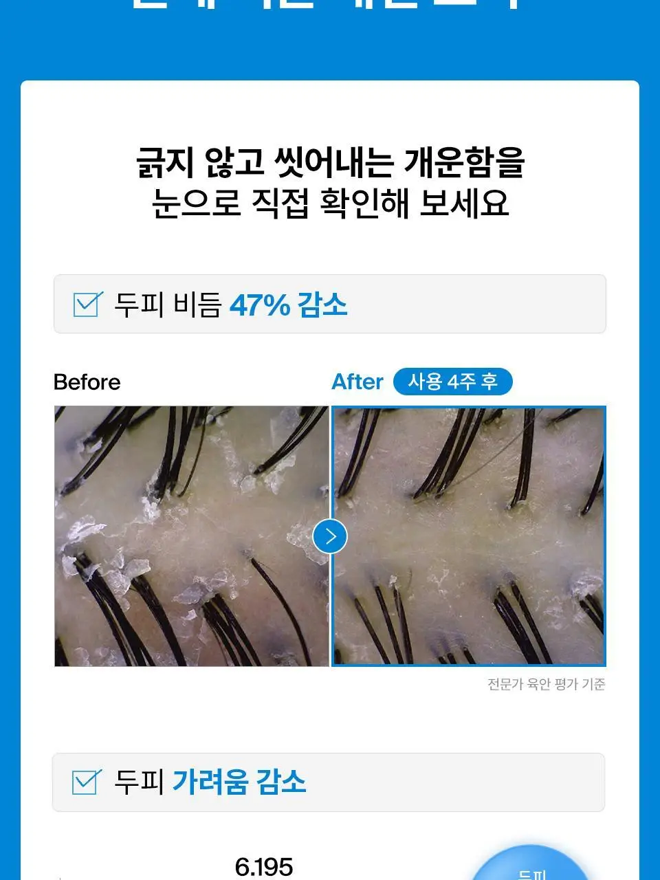 [비듬샴푸 단독기획] 닥터포헤어 에어로 퓨리파잉 안티댄드러프 비듬샴푸 400ml 기획 (+70ml) 상세페이지 10